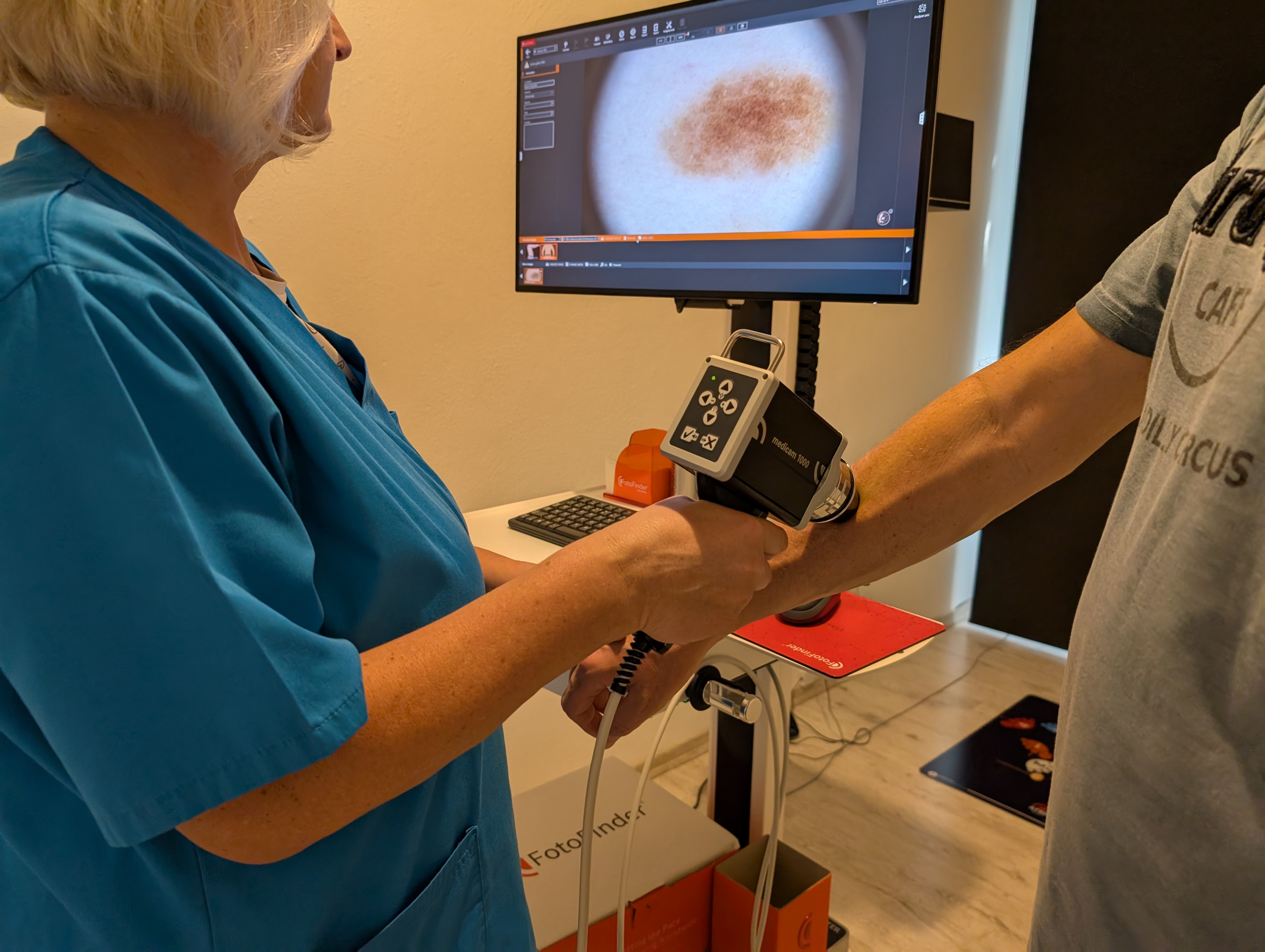 Live dermatoskopické snímanie prístrojom FotoFinder